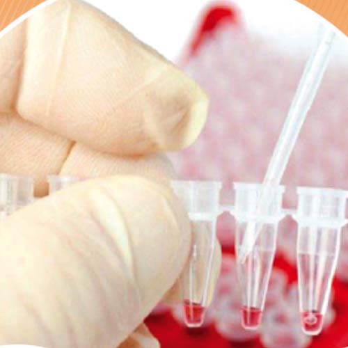 Laboratoire | Réactifs de laboratoire et tests rapides